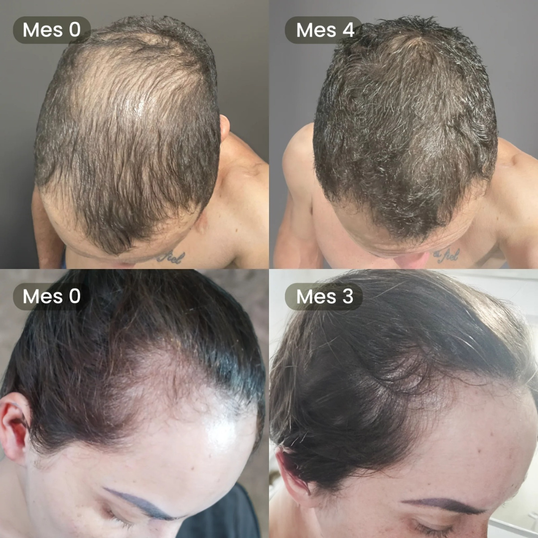 PuroFio HairBooster® - Tónico de crecimiento Capilar y Barba